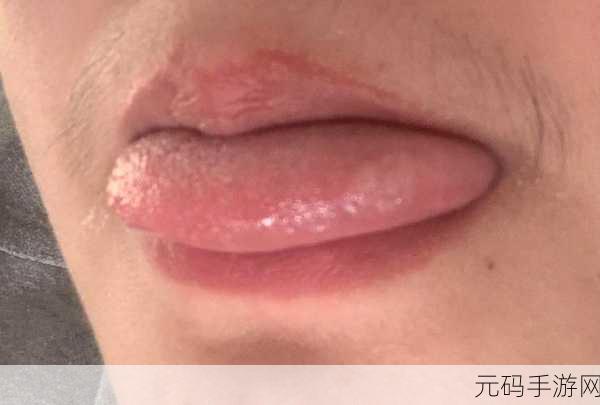 舌头往下舔到一个硬硬的包疼-1. 舌尖探秘：意外发现硬块的背后故事
