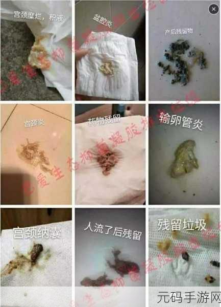 老中医用嘴排阴毒小雨的治疗方法:1. 古法养生:口腔排毒与健康之道