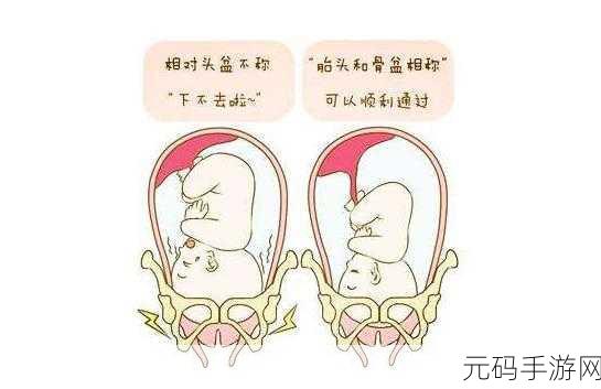 双腿间硬硬的胎头湿漉漉的挤出来的情况如何应对：1. 如何应对分娩时胎头露出带来的不适