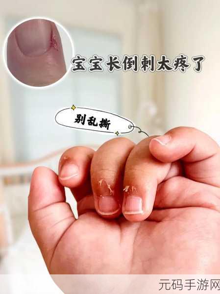 宝宝怎么才三根手指就痛:1. 宝宝三根手指受伤,如何有效缓解疼痛?