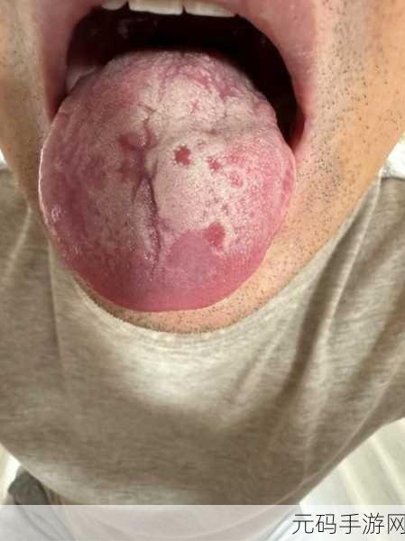 舌头往下舔到一个硬硬的包疼:舌头舔到硬块引发的疼痛与健康隐患探讨