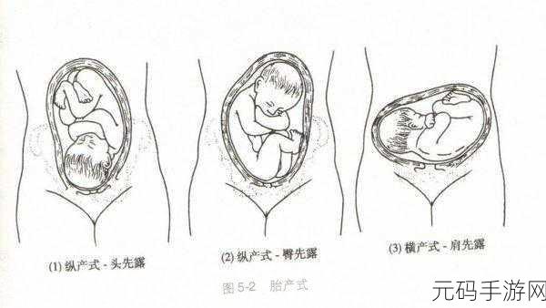 双腿间硬硬的胎头湿漉漉的挤出来的情况如何应对：1. 如何应对双腿间胎头湿漉漉的产程挑战