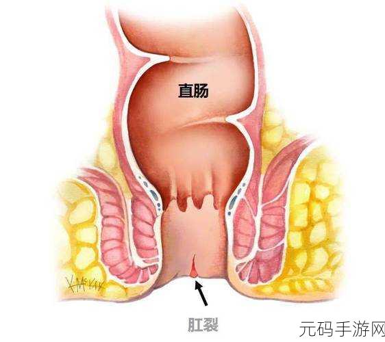 肛门口摸到个软软的肉要怎么消除：1. 如何识别肛门区域的异常软组织？