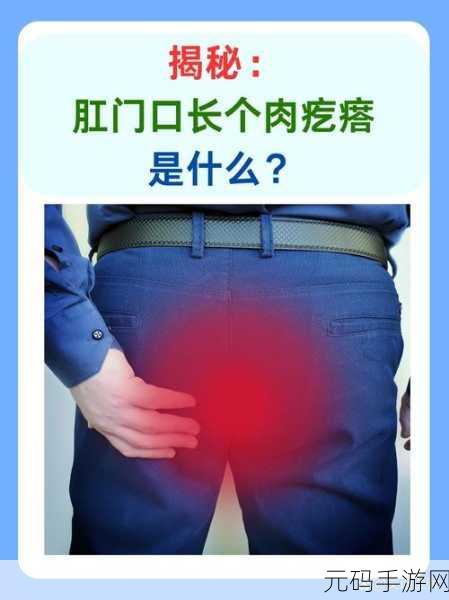 肛门口摸到个软软的肉要怎么消除：1. 如何识别肛门区域的异常软组织？