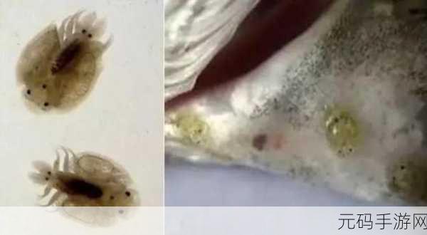 叔叔说我体内有虫子:1. 体内虫子暗藏的健康危机