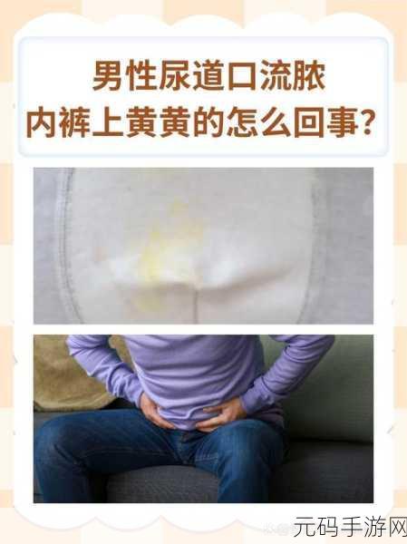 每次跟男朋友口完嗓子都发炎：1. 每次约会后嗓子发炎，如何避免这个困扰？