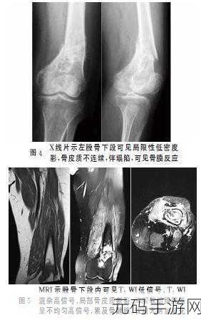 野骨骨科1 v1：以下是一些基于“野骨骨科1 v1”的扩展